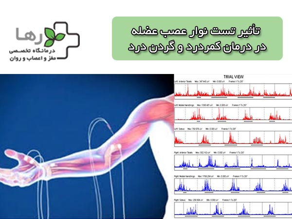 تاثیر تست نوار عصب عضله