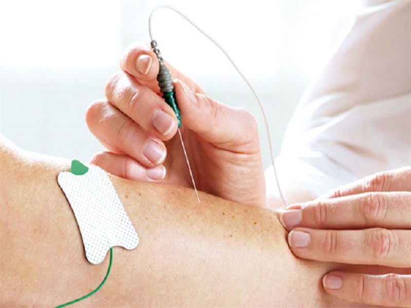 EMG-pain.jpg