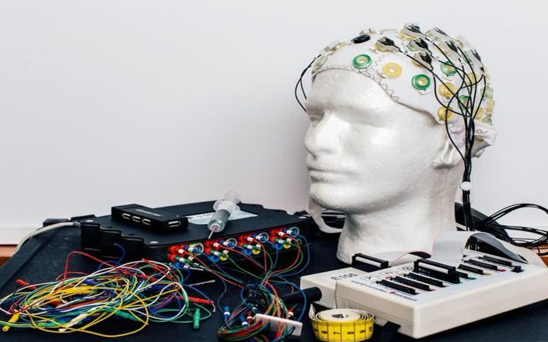  تحریک الکتریکی مغز TDCS