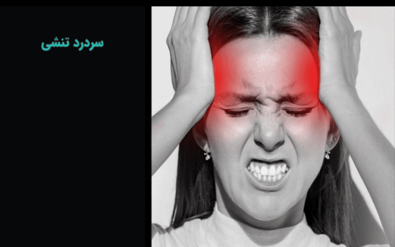 سردرد