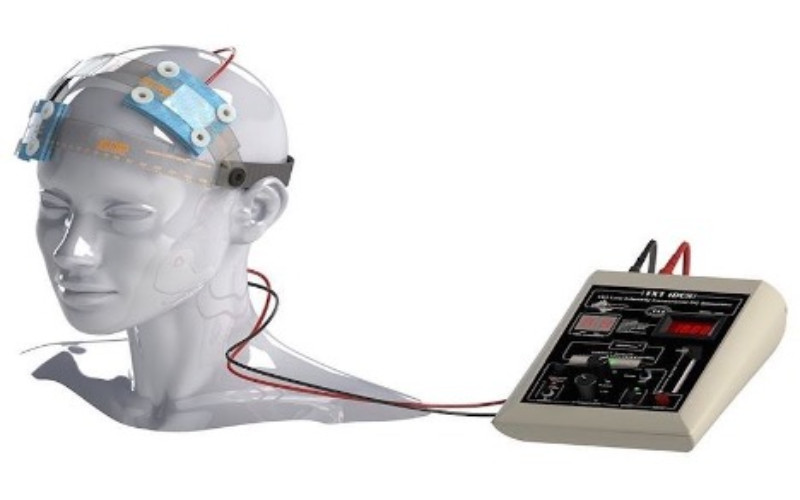 تفاوت نوروفیدبک با tDCS