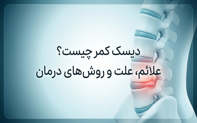 دیسک-کمر-چیست؟-علائم،-علت-و-روش_های-درمان-.jpg